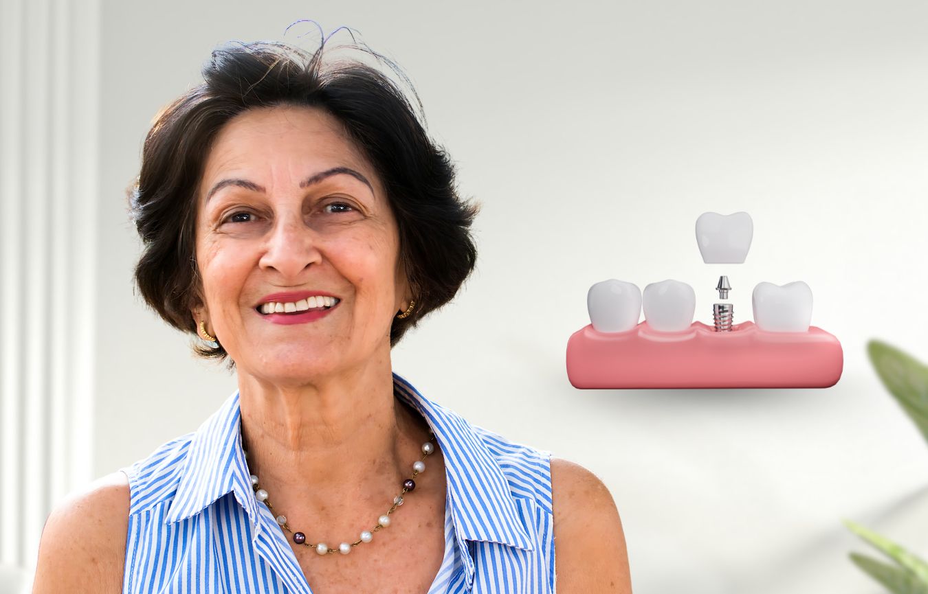 Dental Implants In Nayapalli