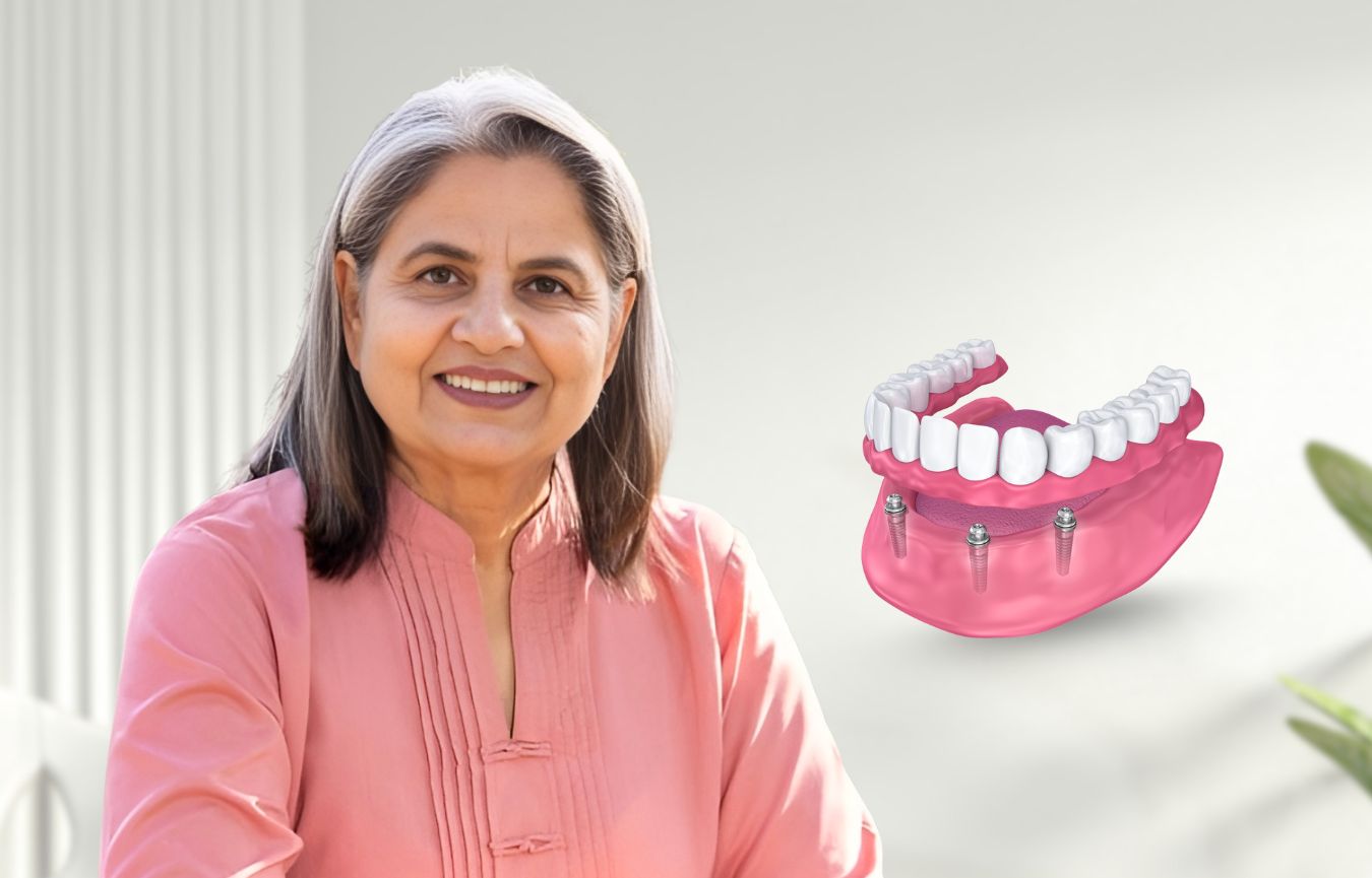 Overdentures In Nayapalli