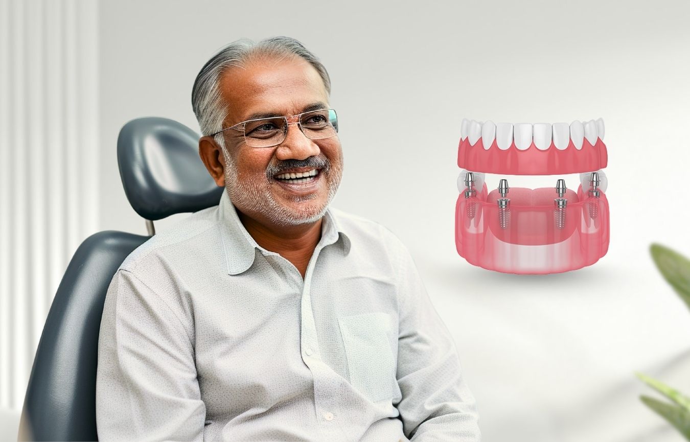 All-on-4 & All-on-6 Dental Implants In Nayapalli