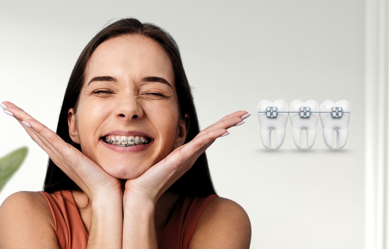 Braces Treatment In Nayapalli