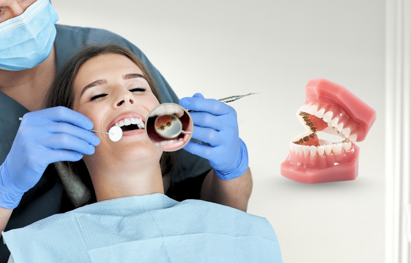 Lingual Braces In Nayapalli