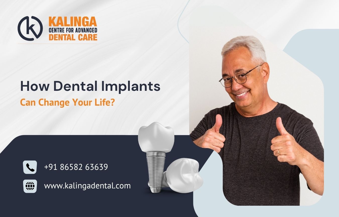 How Dental Implants Can Change Your Life