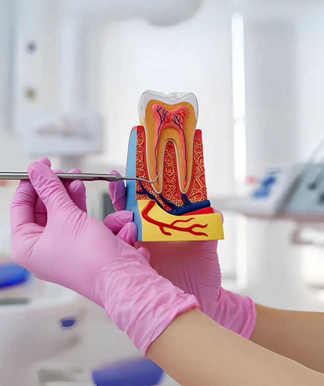 Root-Canal-Treatment