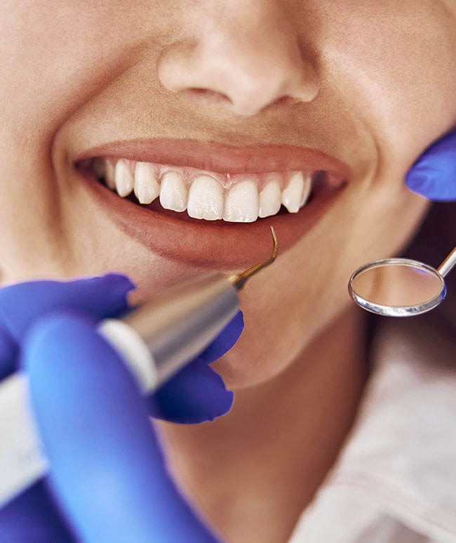 Teeth-Cleaning