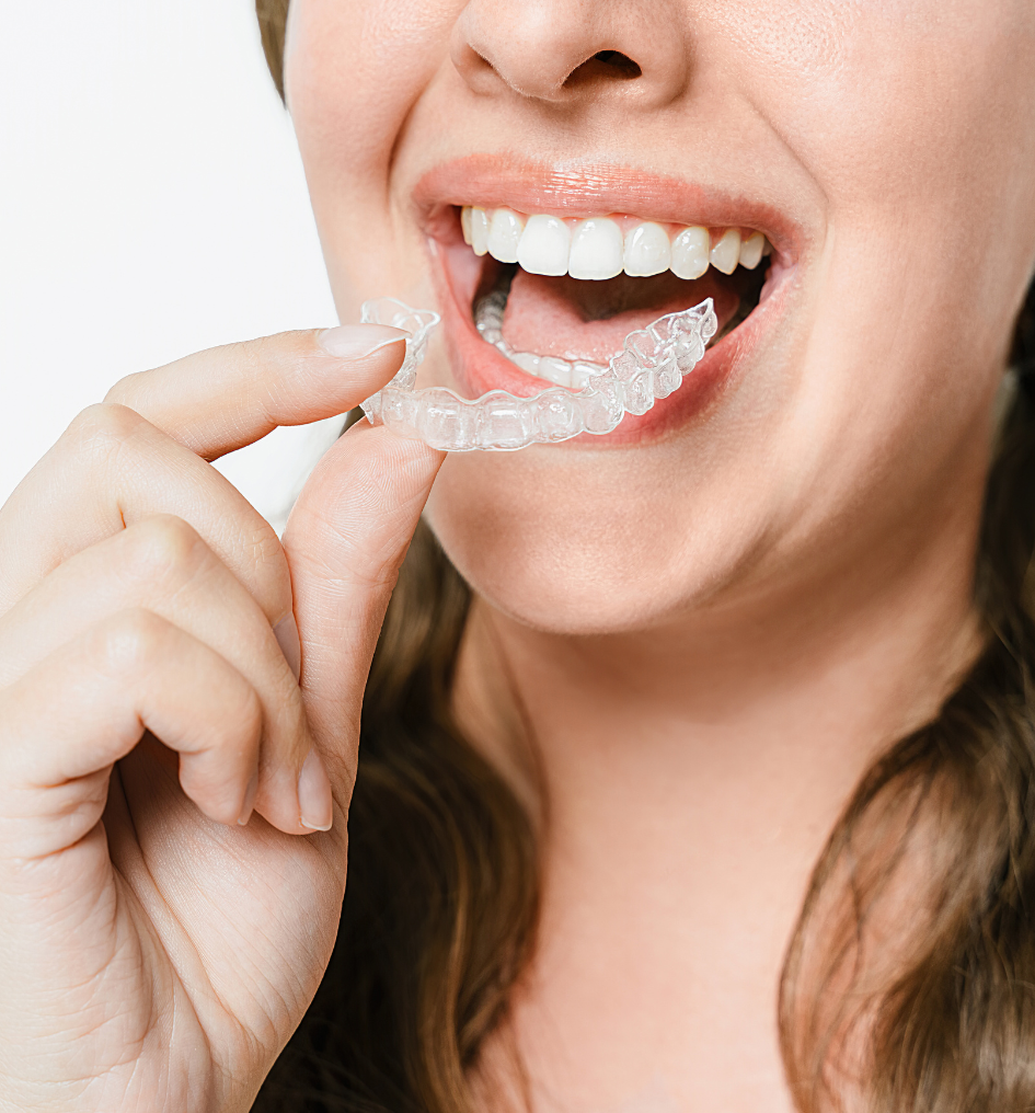 Wearing-the-Aligners
